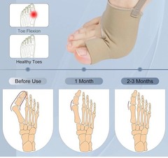2Pcs Bunion Corrector Women Men Big Toe Separator Hammer Straightener w/ Grip